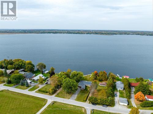309 Snug Harbour Rd, Kawartha Lakes, ON - Outdoor With Body Of Water With View