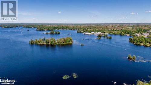 36 Yellowhead Island, Port Severn, ON - Outdoor With Body Of Water With View