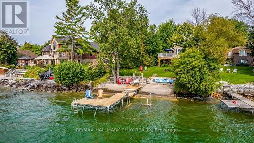 1069 Lakeshore Rd E, Oro-Medonte, ON - Outdoor With Body Of Water