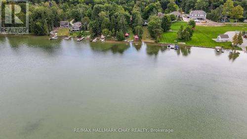 2100 South Orr Lake Rd, Springwater, ON - Outdoor With Body Of Water With View