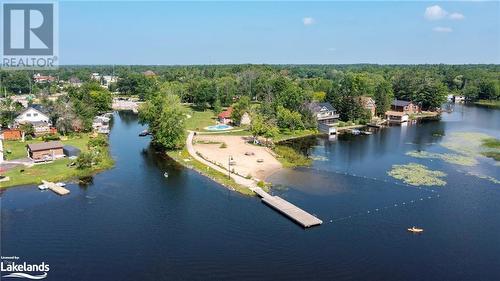 49 Mintens Lane E, Port Severn, ON - Outdoor With Body Of Water With View