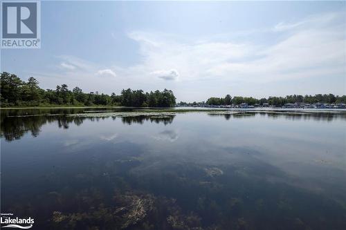 49 Mintens Lane E, Port Severn, ON - Outdoor With Body Of Water With View