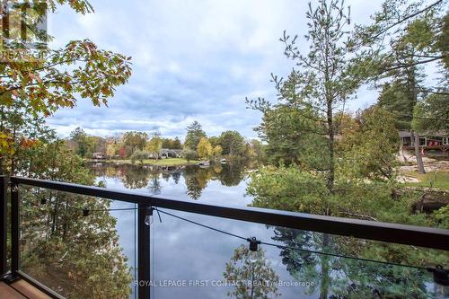 8098 Laidlaw Avenue, Ramara, ON - Outdoor With Body Of Water With View