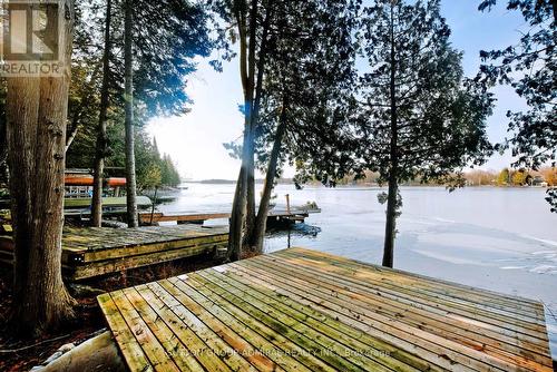 308 Indian Point Road, Kawartha Lakes, ON - Outdoor With Body Of Water With View