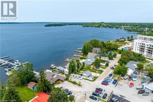 21 Oriole Road, Kawartha Lakes, ON - Outdoor With Body Of Water With View