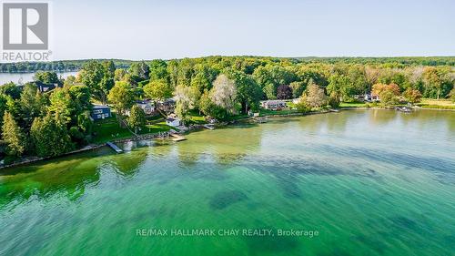47 Moon Point Dr, Oro-Medonte, ON - Outdoor With Body Of Water With View
