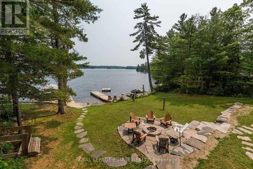 2377 Orimat Road, Severn, ON - Outdoor With Body Of Water With View