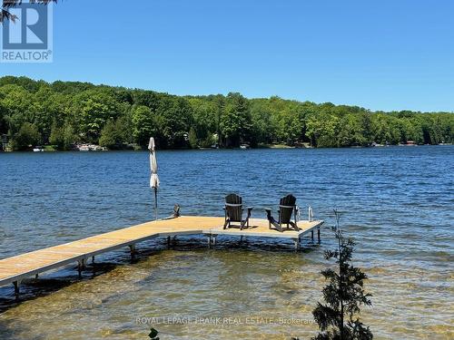 936 Patterson Road, Douro-Dummer, ON - Outdoor With Body Of Water With View