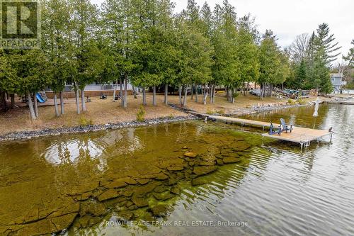 936 Patterson Rd, Douro-Dummer, ON - Outdoor With Body Of Water