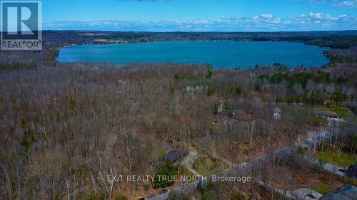 1792 Little Ninth Rd, Springwater, ON - Outdoor With Body Of Water With View