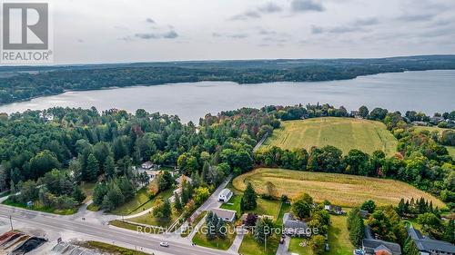 8732 Hwy 12, Oro-Medonte, ON - Outdoor With Body Of Water With View