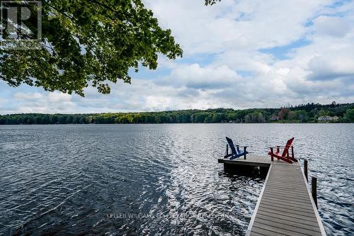 180 Farlain Lake Rd E, Tiny, ON - Outdoor With Body Of Water With View