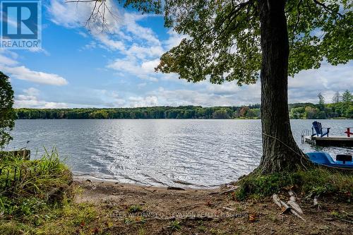 180 Farlain Lake Road E, Tiny, ON - Outdoor With Body Of Water With View