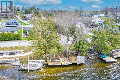 4 Hollyville Boulevard, Kawartha Lakes, ON - Outdoor With View