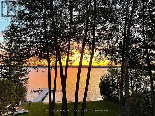 784 Birchview Rd, Douro-Dummer, ON - Outdoor With View