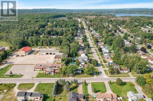 444 Park Street, Tay, ON - Outdoor With View