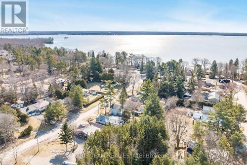 3314 Pleasant Road, Severn, ON - Outdoor With Body Of Water With View