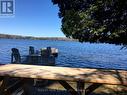 1034 Canning Heights Road, Minden Hills, ON  - Outdoor With Body Of Water With View 