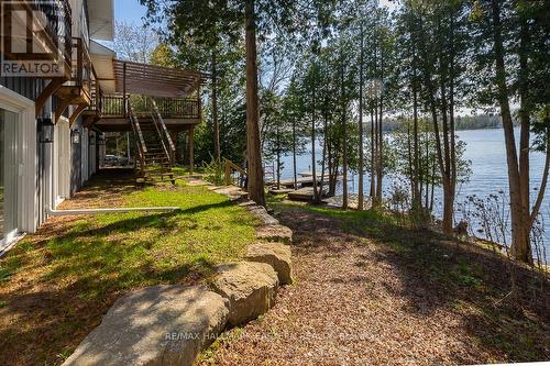 308 Indian Point Road, Kawartha Lakes, ON - Outdoor With Body Of Water