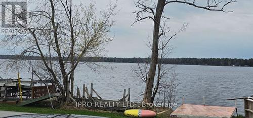53 Hazel Street, Kawartha Lakes, ON - Outdoor With Body Of Water With View