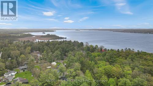 8 Parkhill Drive, Kawartha Lakes, ON - Outdoor With Body Of Water With View
