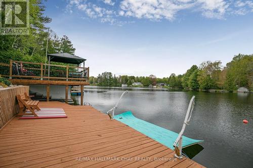 79 Stanley Road, Kawartha Lakes, ON - Outdoor With Body Of Water With Deck Patio Veranda With View