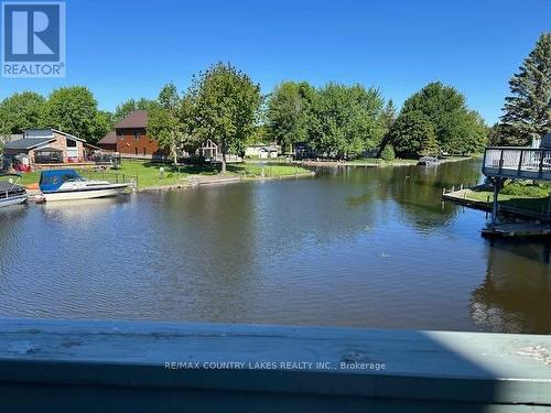 6 - 30 Laguna Parkway, Ramara (Brechin), ON - Outdoor With Body Of Water With View