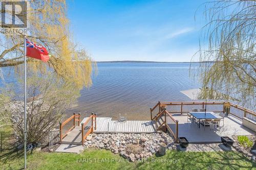 282 Robins Point Road, Tay, ON - Outdoor With Body Of Water