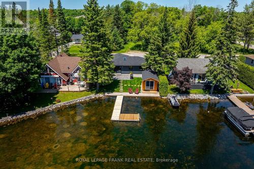 178 Front Street W, Kawartha Lakes, ON - Outdoor With Body Of Water