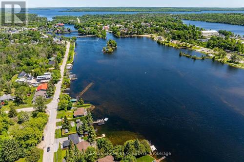 178 Front Street W, Kawartha Lakes, ON - Outdoor With Body Of Water With View