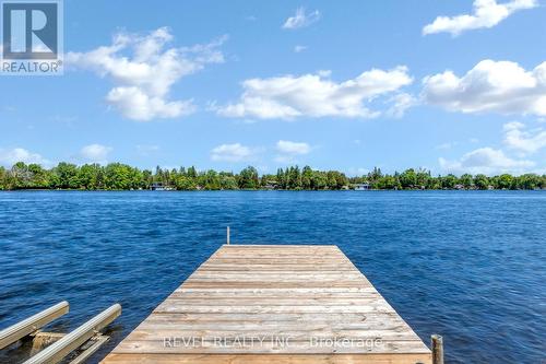 241 Raby'S Shore Drive, Kawartha Lakes (Fenelon Falls), ON - Outdoor With Body Of Water With View