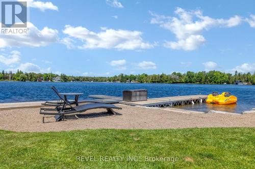 241 Raby'S Shore Drive, Kawartha Lakes (Fenelon Falls), ON - Outdoor With Body Of Water With View