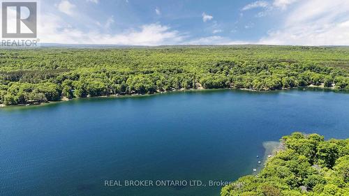 87 Farlain Lake Road E, Tiny, ON - Outdoor With Body Of Water With View