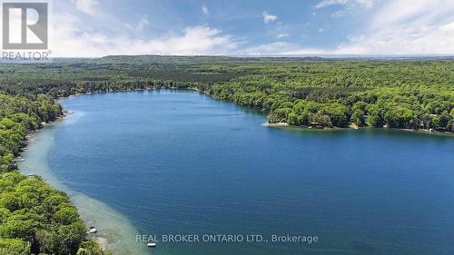 87 Farlain Lake Road E, Tiny, ON - Outdoor With Body Of Water With View