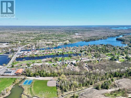 2894 County Road 48 Road, Kawartha Lakes, ON - Outdoor With Body Of Water With View