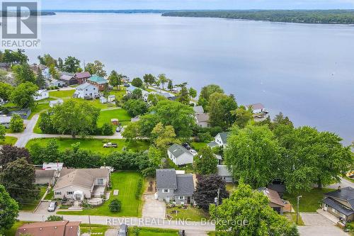 13 Third Street, Kawartha Lakes, ON - Outdoor With Body Of Water With View