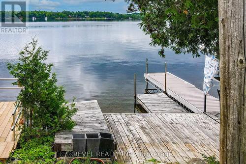 13 Third Street, Kawartha Lakes, ON - Outdoor With Body Of Water With Deck Patio Veranda With View