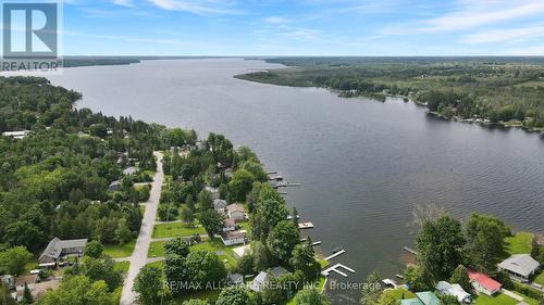 43 Sturgeon Glen Road, Kawartha Lakes, ON - Outdoor With Body Of Water With View