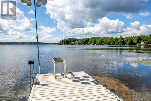 173 Adam And Eve Road, Galway-Cavendish And Harvey, ON - Outdoor With Body Of Water With View