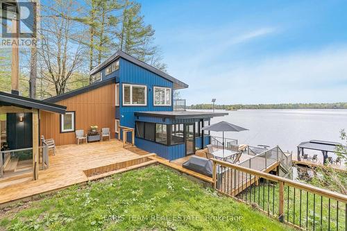1059 Torpitt Road, Severn, ON - Outdoor With Body Of Water With Deck Patio Veranda With Exterior