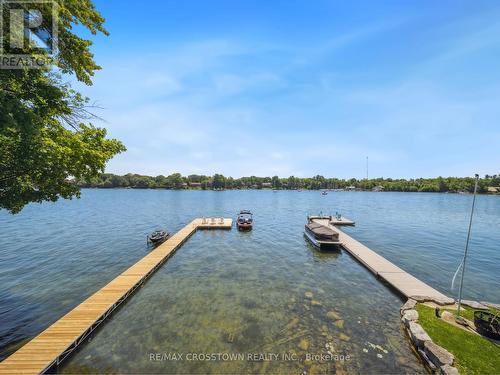 201 Cedar Island Road, Orillia, ON - Outdoor With Body Of Water With View