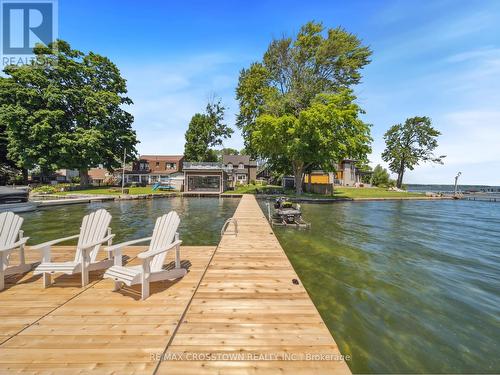 201 Cedar Island Road, Orillia, ON - Outdoor With Body Of Water With View