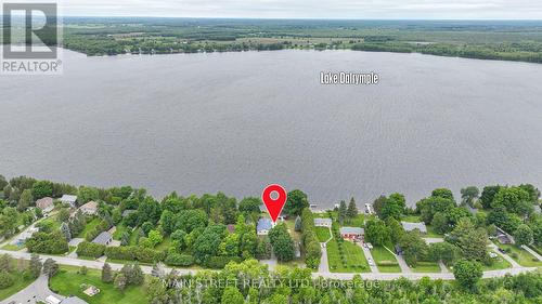 61 Campbell Beach Road, Kawartha Lakes, ON - Outdoor With View