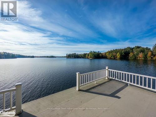 399 Horseshoe, Seguin, ON - Outdoor With Body Of Water With View