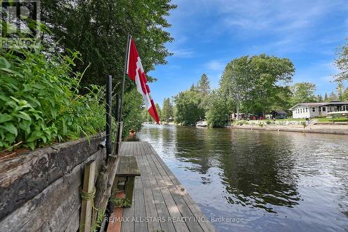 24 River Road, Kawartha Lakes, ON - Outdoor With Body Of Water