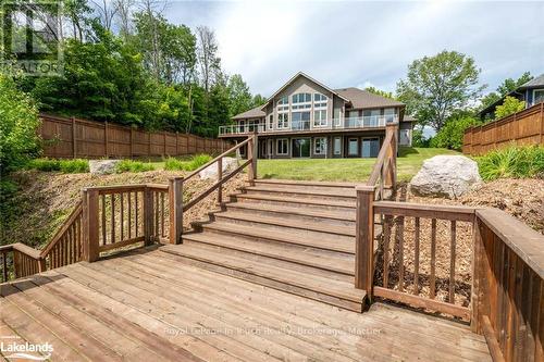 57A Maplewood Parkway, Oro-Medonte, ON - Outdoor With Deck Patio Veranda With Exterior