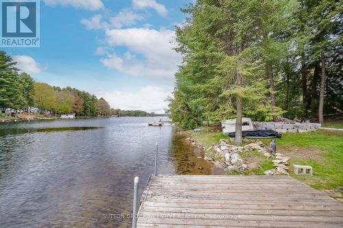1954 South Beaver Lake Lane, Minden Hills, ON - Outdoor With Body Of Water With View