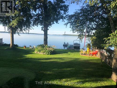 3903 Treeline Drive, Severn, ON - Outdoor With Body Of Water