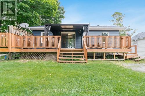 6582 Yonge Street, Innisfil, ON - Outdoor With Deck Patio Veranda