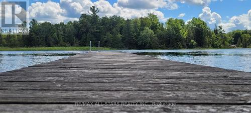 136 Coldstream Road, Kawartha Lakes, ON - Outdoor With Body Of Water With View